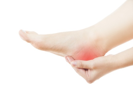 What Are Heel Spurs And How to Treat Them?